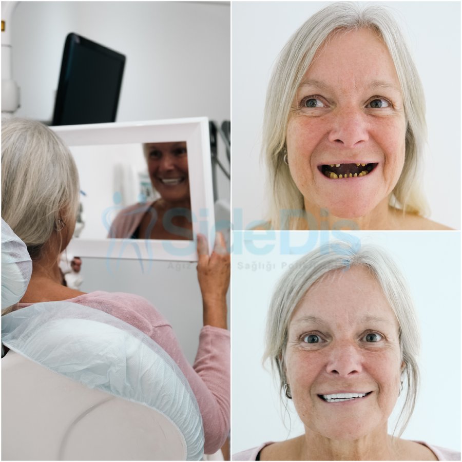 Özel Side Ağız ve Diş Sağlığı Polikliniği - Özel Side Ağız ve Diş Sağlığı Polikliniği