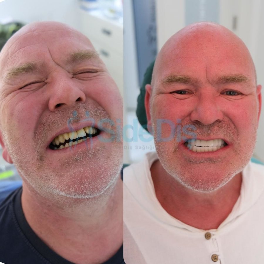 Özel Side Ağız ve Diş Sağlığı Polikliniği - Özel Side Ağız ve Diş Sağlığı Polikliniği