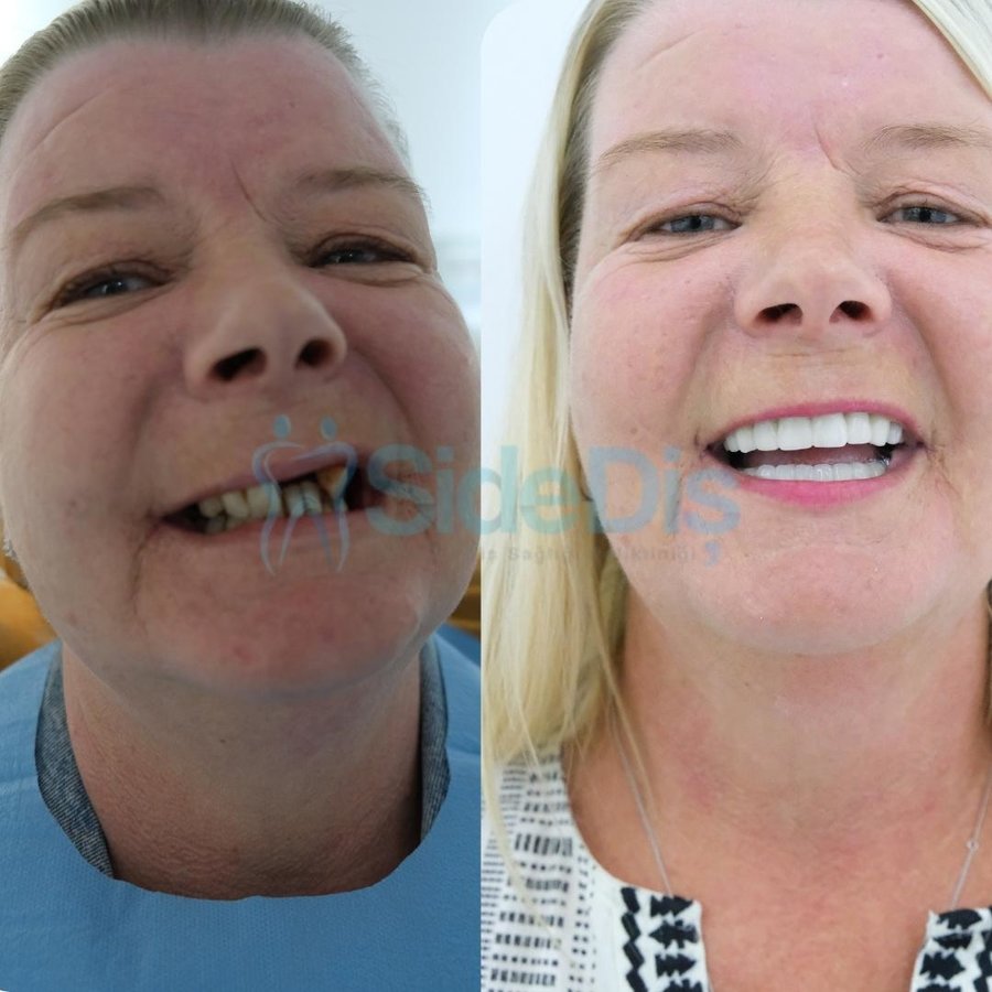 Özel Side Ağız ve Diş Sağlığı Polikliniği - Özel Side Ağız ve Diş Sağlığı Polikliniği