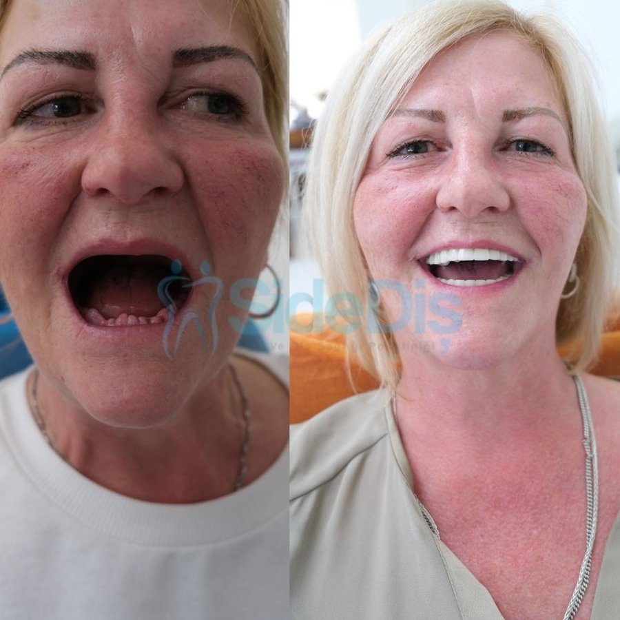 Özel Side Ağız ve Diş Sağlığı Polikliniği - Özel Side Ağız ve Diş Sağlığı Polikliniği