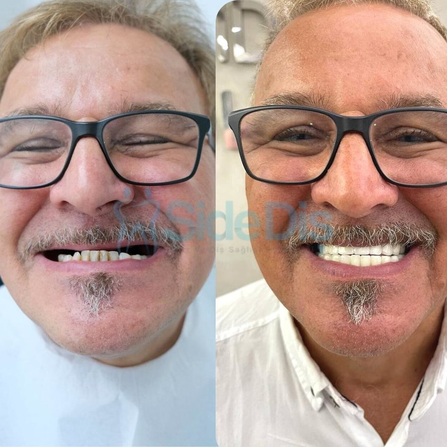 Özel Side Ağız ve Diş Sağlığı Polikliniği - Özel Side Ağız ve Diş Sağlığı Polikliniği