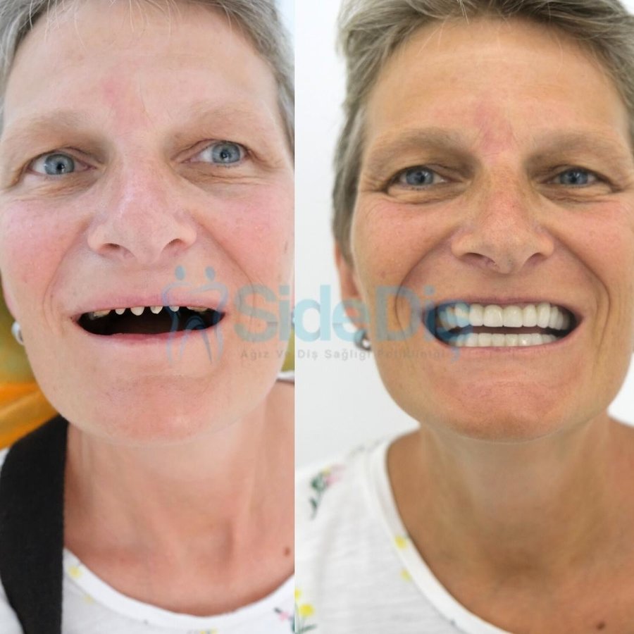 Özel Side Ağız ve Diş Sağlığı Polikliniği - Özel Side Ağız ve Diş Sağlığı Polikliniği