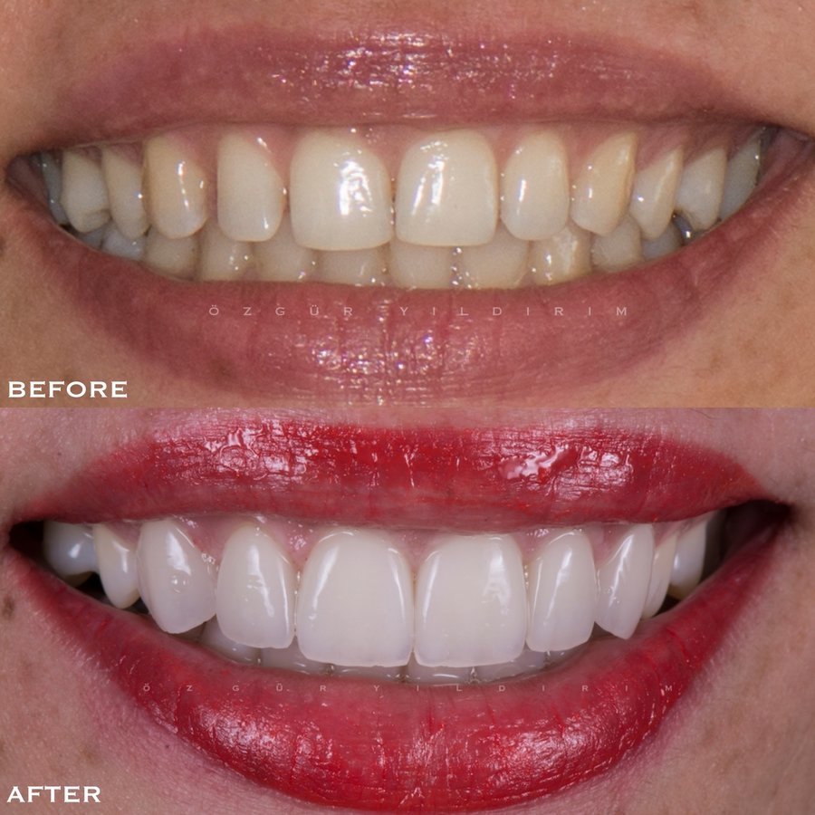 عيادة أوزغور يلدريم للأسنان التجميلية - Özgür Yıldırım Aesthetic Dental Clinic