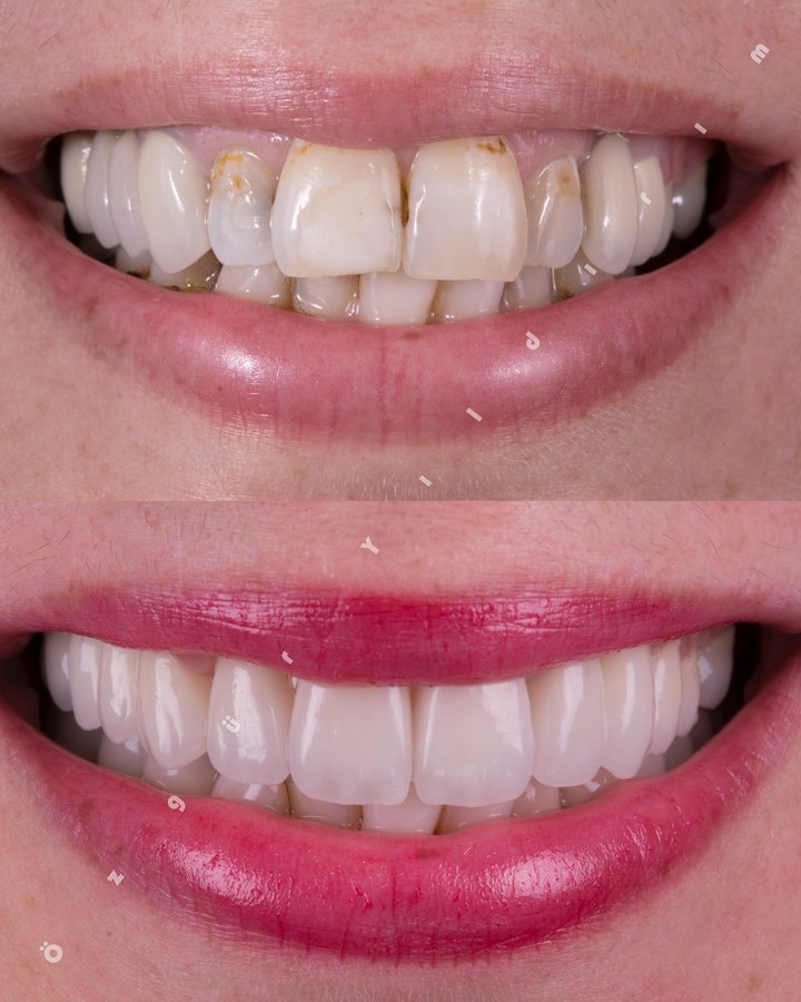 عيادة أوزغور يلدريم للأسنان التجميلية - Özgür Yıldırım Aesthetic Dental Clinic