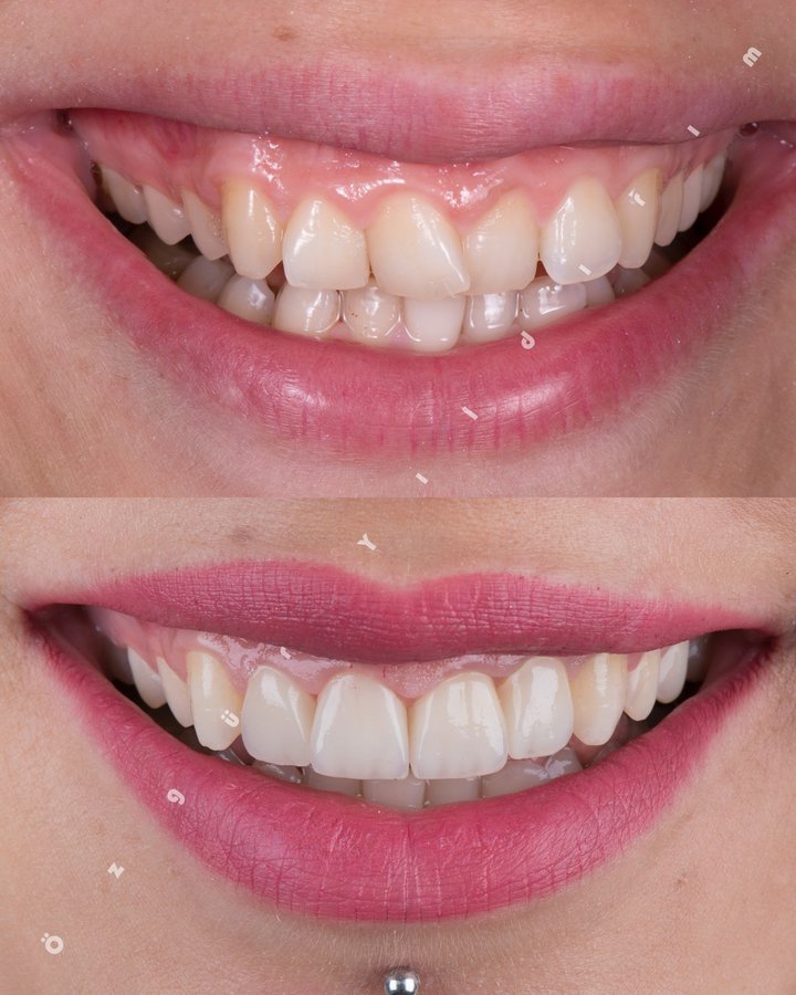 عيادة أوزغور يلدريم للأسنان التجميلية - Özgür Yıldırım Aesthetic Dental Clinic