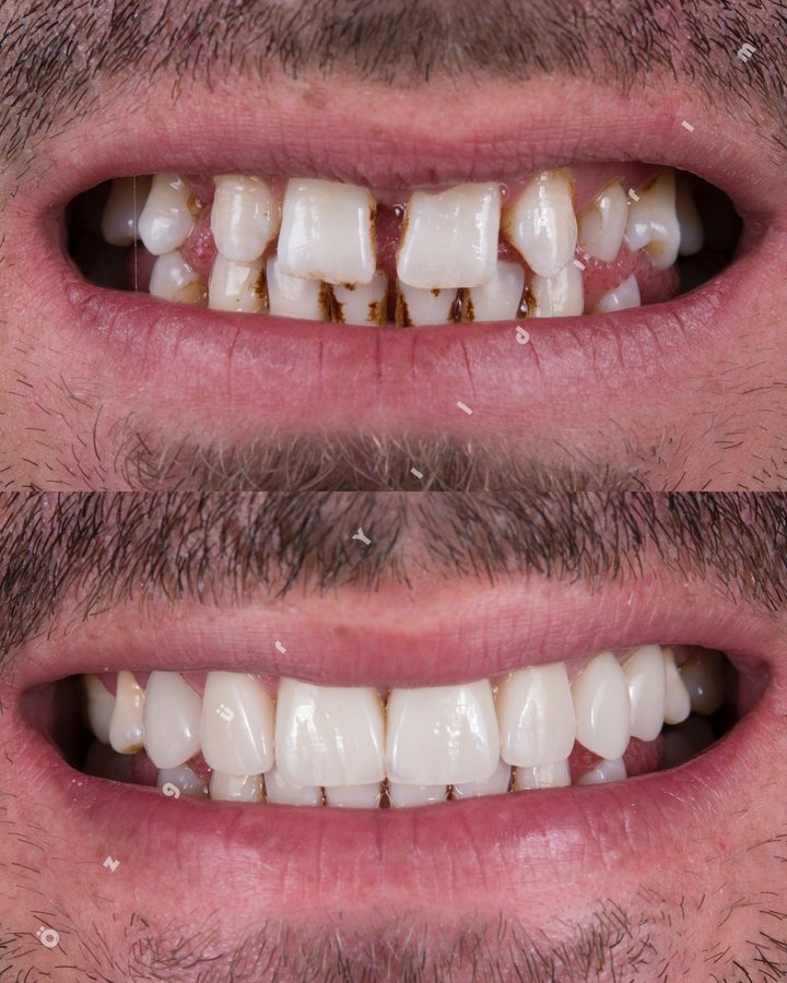 عيادة أوزغور يلدريم للأسنان التجميلية - Özgür Yıldırım Aesthetic Dental Clinic