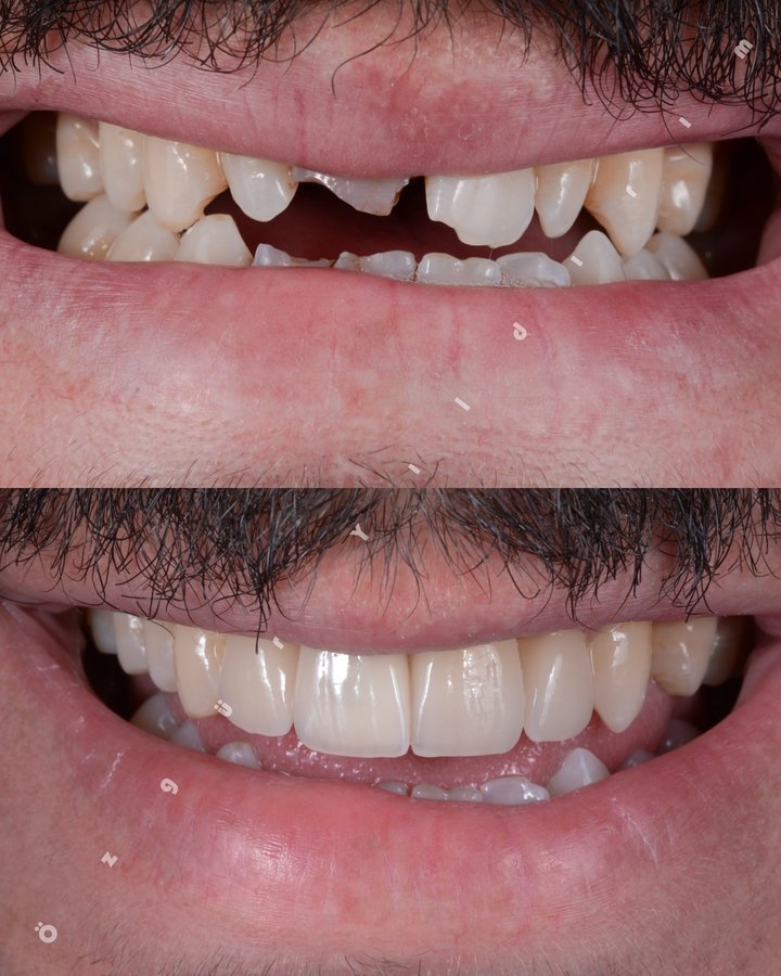 عيادة أوزغور يلدريم للأسنان التجميلية - Özgür Yıldırım Aesthetic Dental Clinic