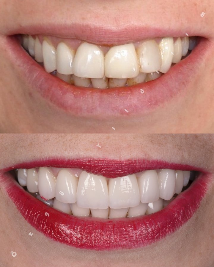 عيادة أوزغور يلدريم للأسنان التجميلية - Özgür Yıldırım Aesthetic Dental Clinic