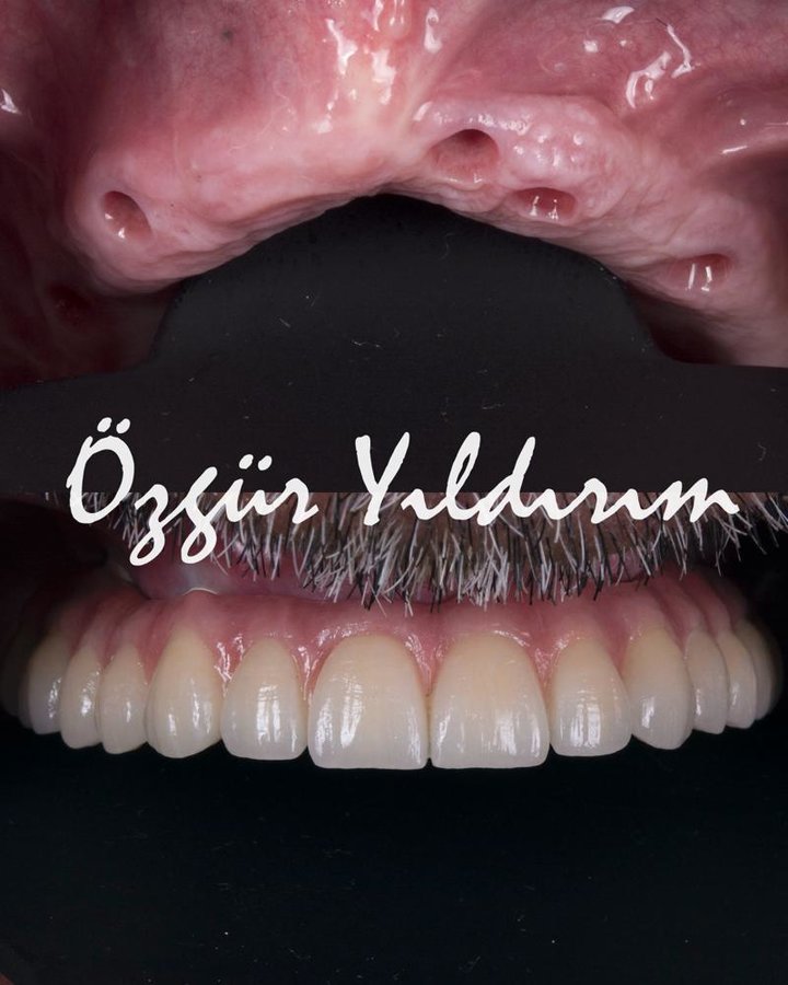 عيادة أوزغور يلدريم للأسنان التجميلية - Özgür Yıldırım Aesthetic Dental Clinic