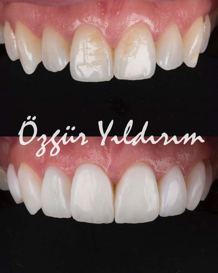 عيادة أوزغور يلدريم للأسنان التجميلية - Özgür Yıldırım Aesthetic Dental Clinic
