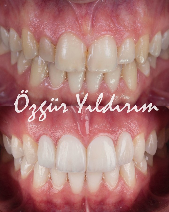 عيادة أوزغور يلدريم للأسنان التجميلية - Özgür Yıldırım Aesthetic Dental Clinic