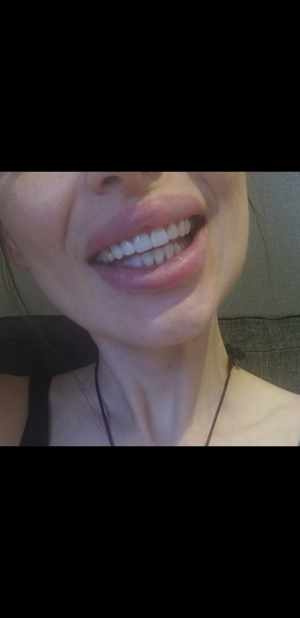 عيادة أوزغور يلدريم للأسنان التجميلية - Özgür Yıldırım Aesthetic Dental Clinic