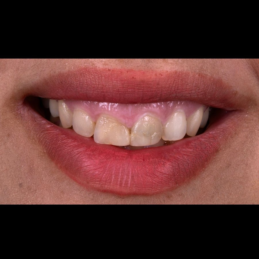عيادة أوزغور يلدريم للأسنان التجميلية - Özgür Yıldırım Aesthetic Dental Clinic