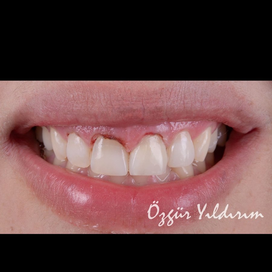 عيادة أوزغور يلدريم للأسنان التجميلية - Özgür Yıldırım Aesthetic Dental Clinic