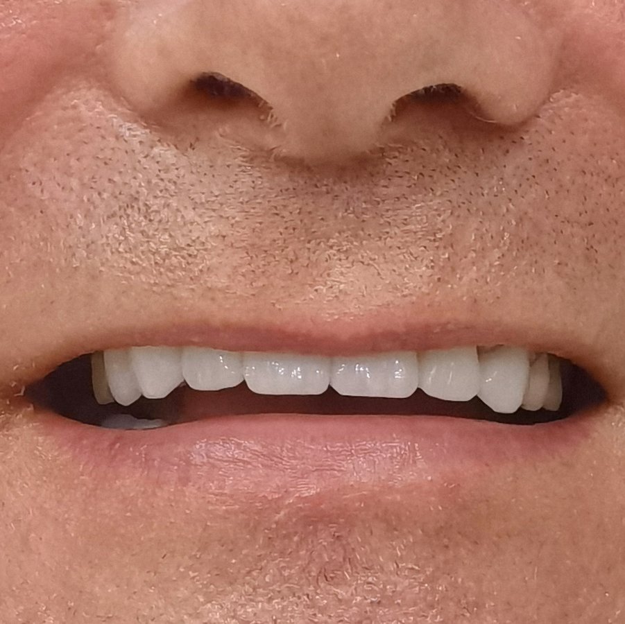 عيادة أوزغور يلدريم للأسنان التجميلية - Özgür Yıldırım Aesthetic Dental Clinic