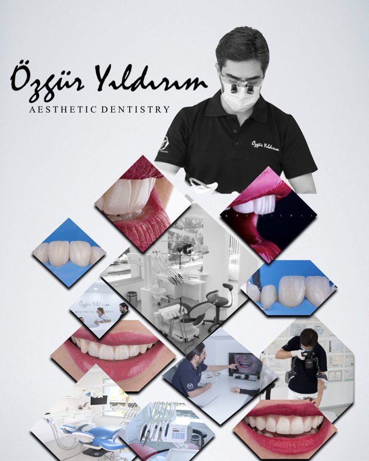 عيادة أوزغور يلدريم للأسنان التجميلية - Özgür Yıldırım Aesthetic Dental Clinic