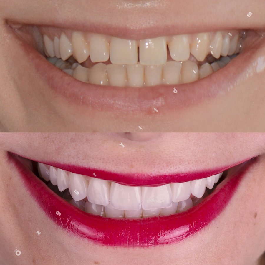 عيادة أوزغور يلدريم للأسنان التجميلية - Özgür Yıldırım Aesthetic Dental Clinic