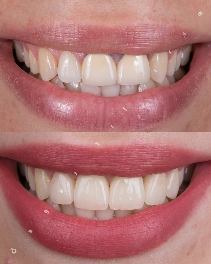 عيادة أوزغور يلدريم للأسنان التجميلية - Özgür Yıldırım Aesthetic Dental Clinic