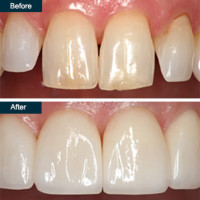 Park Avenue Smiles - Park Avenue Smiles