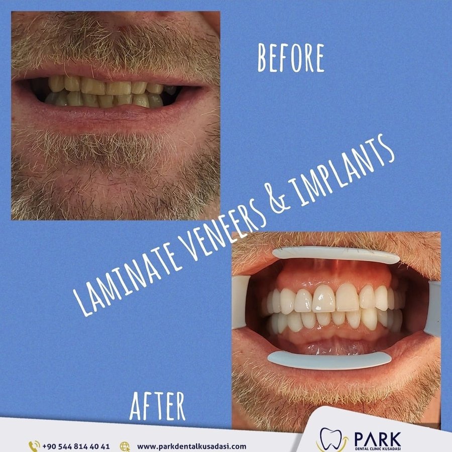 Park Dental - Park Dental