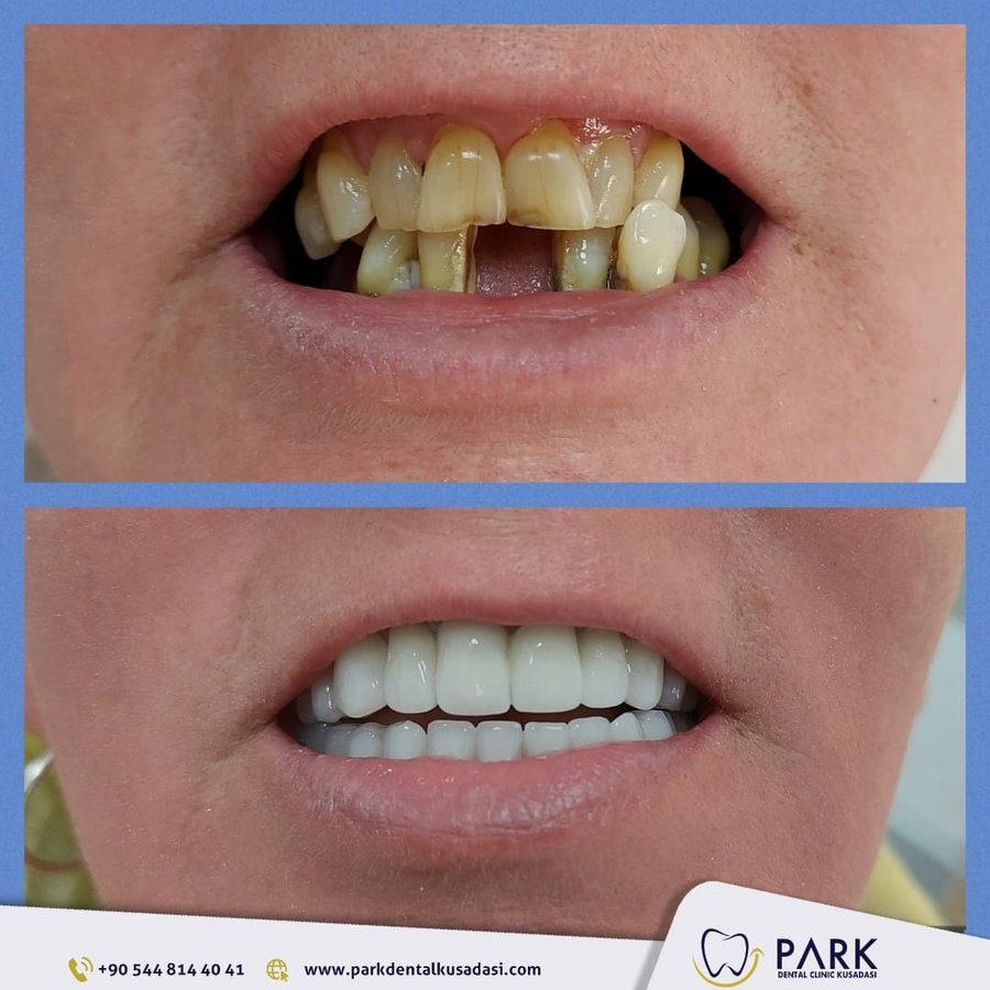 Park Dental - Park Dental