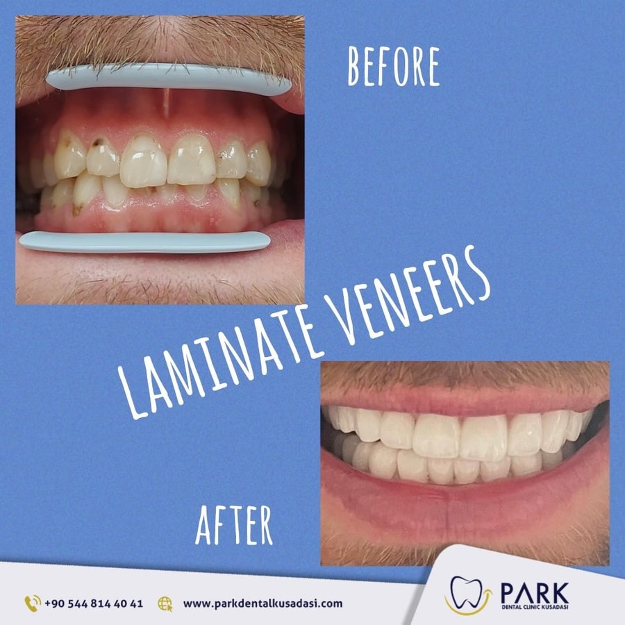 Park Dental - Park Dental