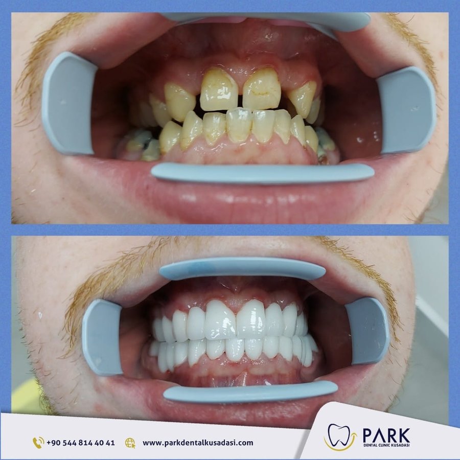 Park Dental - Park Dental