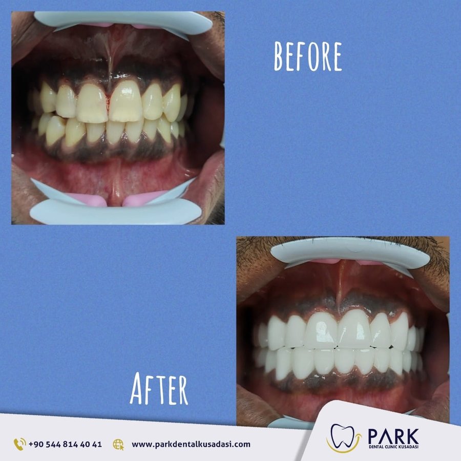 Park Dental - Park Dental