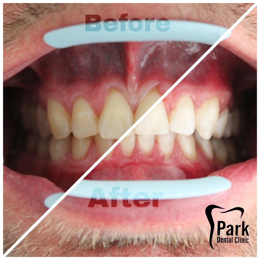 Park Dental - Park Dental