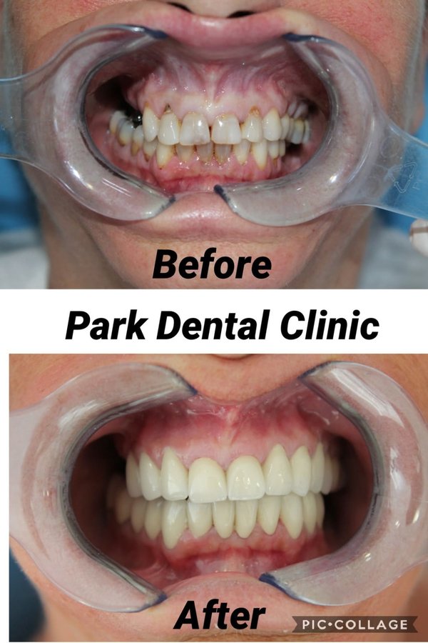 Park Dental - Park Dental