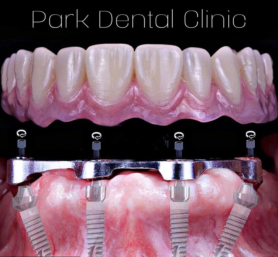 Park Dental - Park Dental