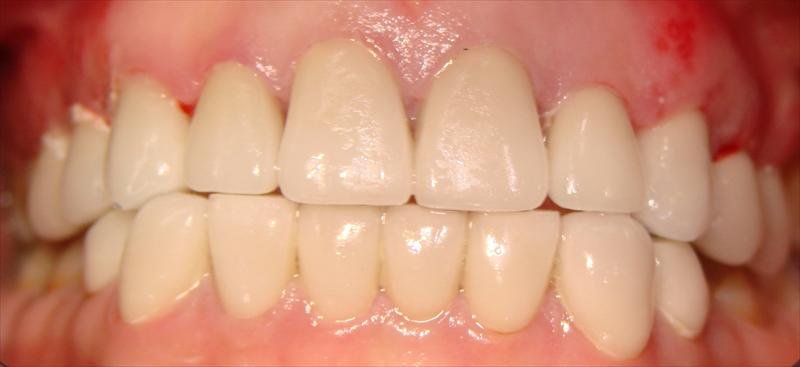 Peace Dental - Peace Dental