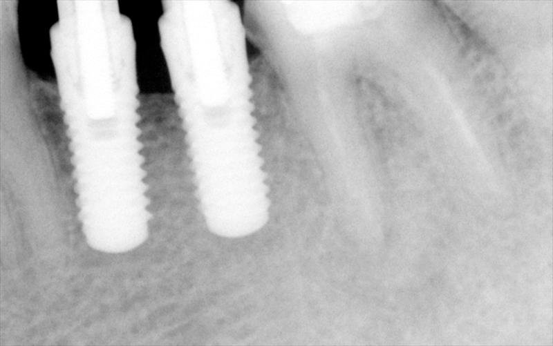 Peace Dental - Peace Dental