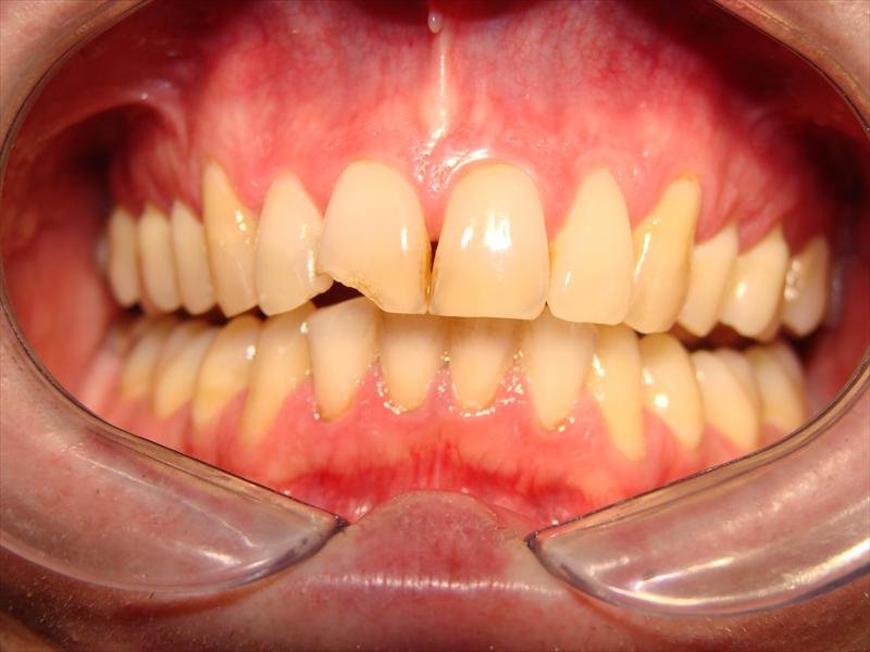 Peace Dental - Peace Dental