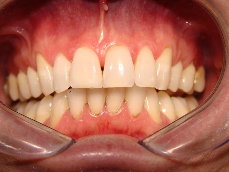 Peace Dental - Peace Dental