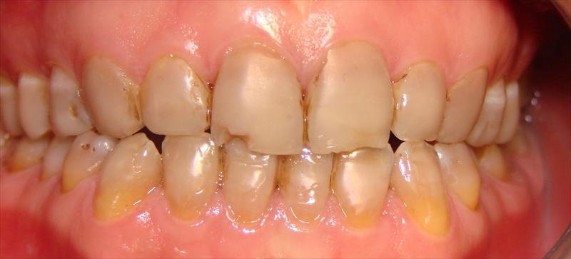 Peace Dental - Peace Dental