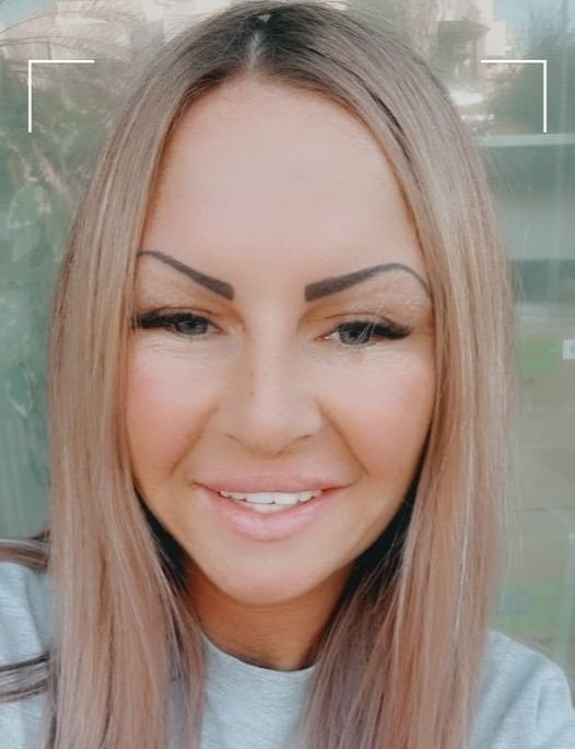 ابتسامة مثالية عيادة الأسنان مرمريس - Perfect Smile Dental Clinic Marmaris