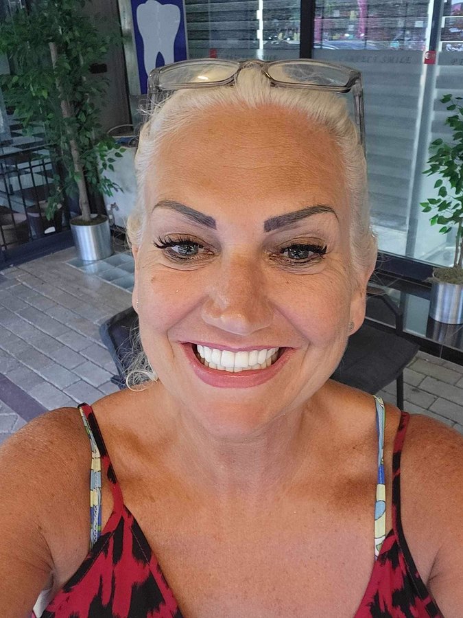 ابتسامة مثالية عيادة الأسنان مرمريس - Perfect Smile Dental Clinic Marmaris