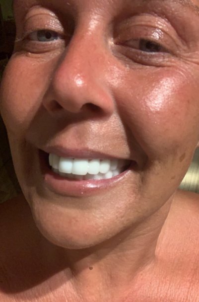 ابتسامة مثالية عيادة الأسنان مرمريس - Perfect Smile Dental Clinic Marmaris