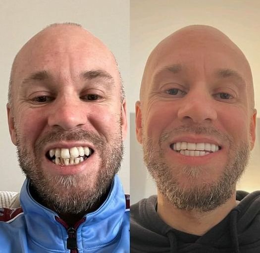 ابتسامة مثالية عيادة الأسنان مرمريس - Perfect Smile Dental Clinic Marmaris