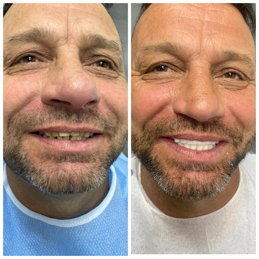 ابتسامة مثالية عيادة الأسنان مرمريس - Perfect Smile Dental Clinic Marmaris