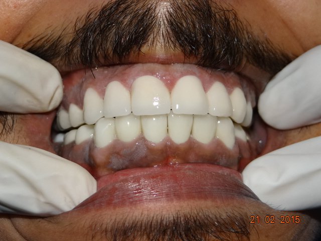 Perfect Smile - Perfect Smile