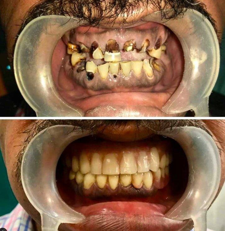 Perfect Teeth Dental Clinic & Facial Aesthetic Centre - Perfect Teeth Dental Clinic & Facial Aesthetic Centre