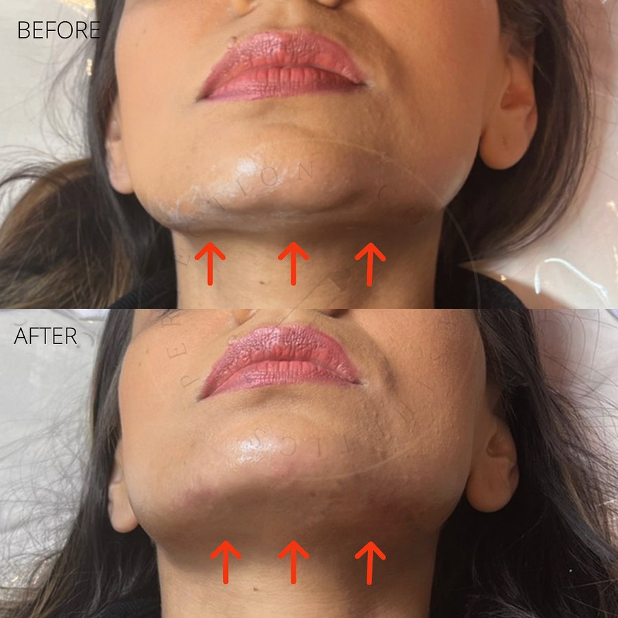 Perfection Co Aesthetics - Perfection Co Aesthetics