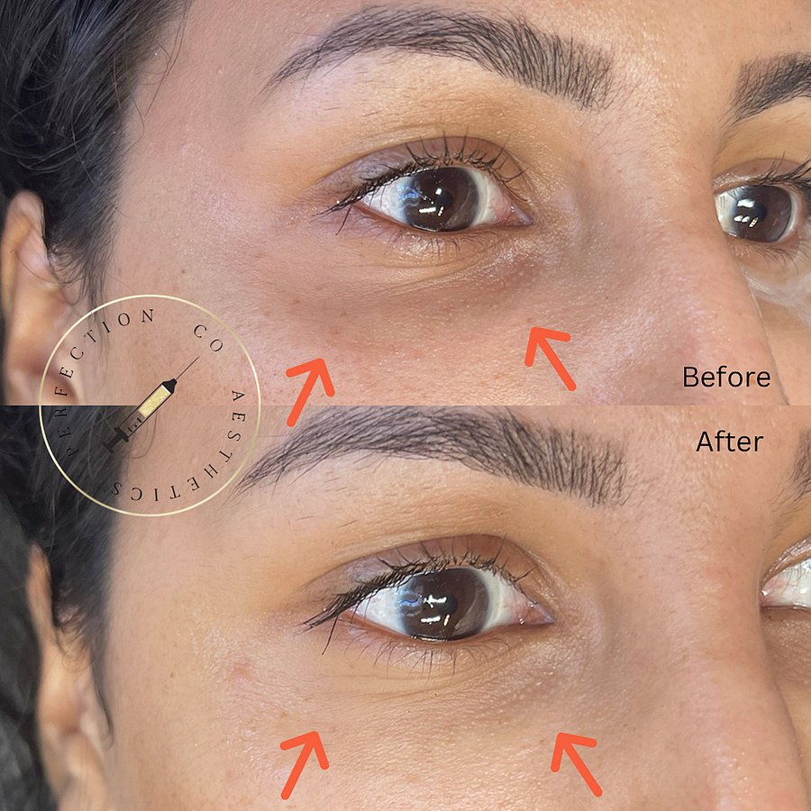 Perfection Co Aesthetics - Perfection Co Aesthetics