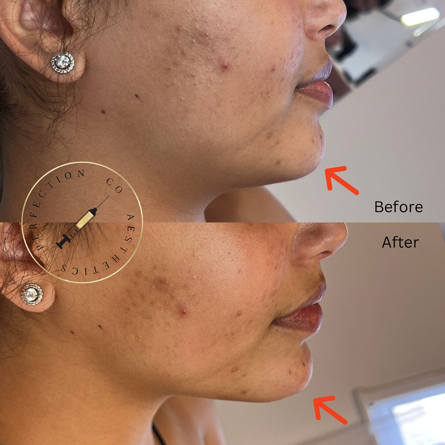 Perfection Co Aesthetics - Perfection Co Aesthetics