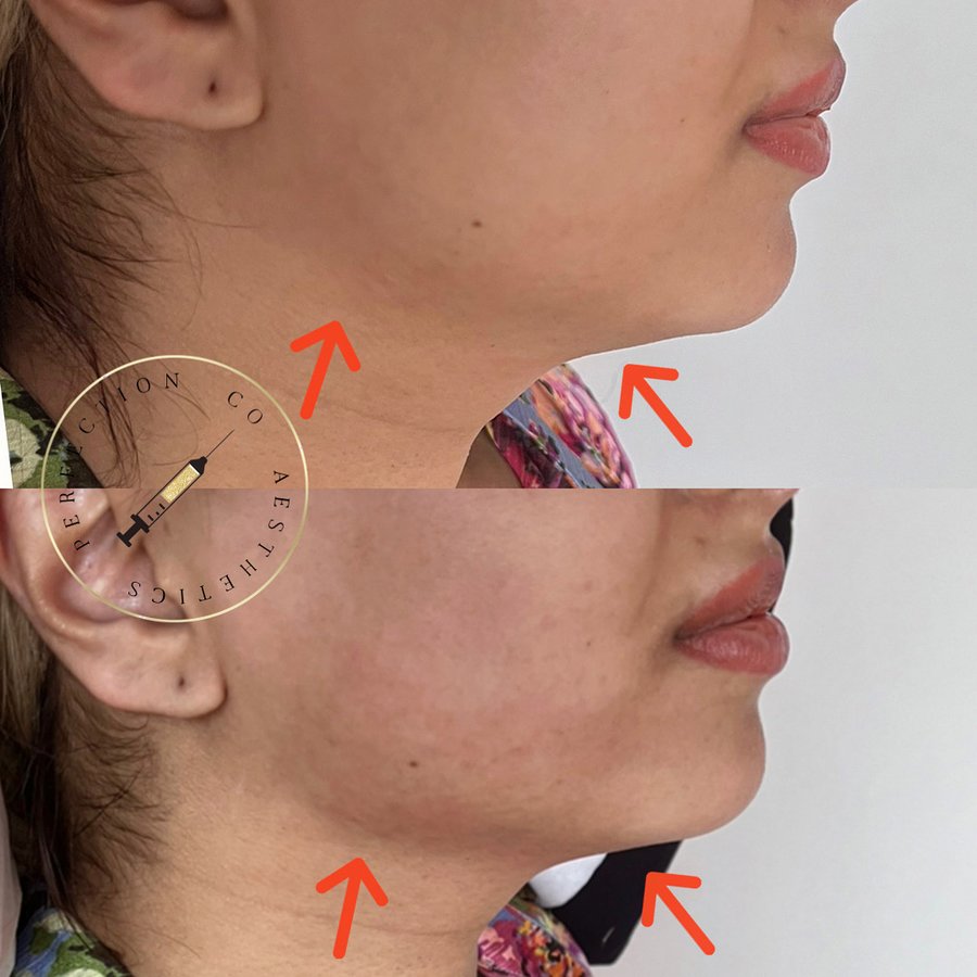 Perfection Co Aesthetics - Perfection Co Aesthetics