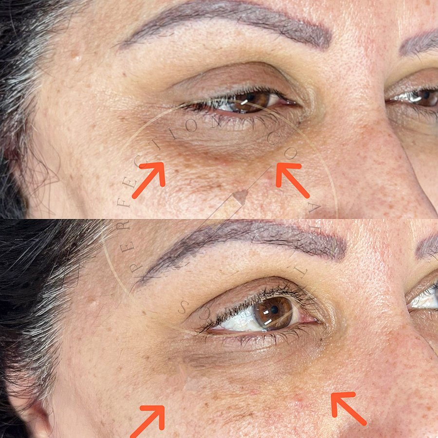 Perfection Co Aesthetics - Perfection Co Aesthetics