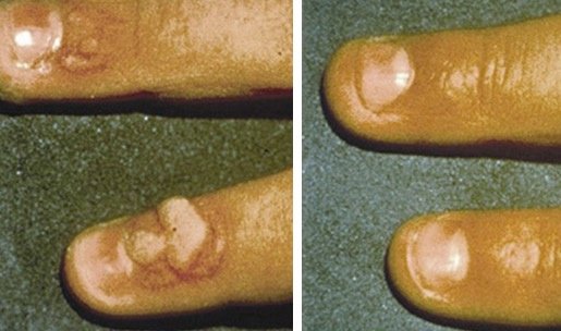 Perfection Cosmetic Laser & Aesthetic Clinic - Fallowfield - Perfection Cosmetic Laser & Aesthetic Clinic - Fallowfield