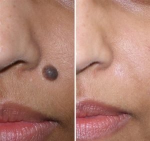 Perfection Cosmetic Laser & Aesthetic Clinic - جروف كلوز - Perfection Cosmetic Laser & Aesthetic Clinic - Grove Close